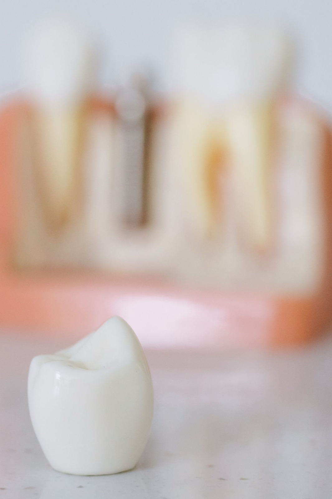 Dente de porcelana em primeiro plano e modelo de implante ao fundo